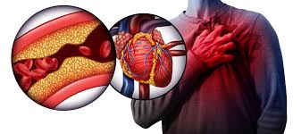 Combatting Hypertension Natural